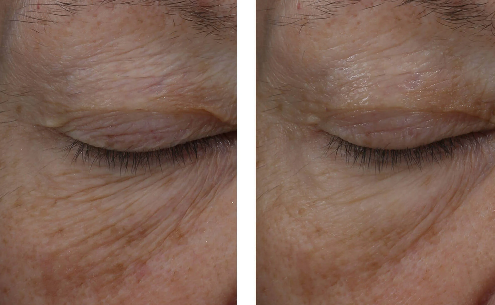 InterFuse Treatment Cream EYE